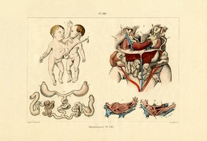 フリーク、1833-39 作： French School